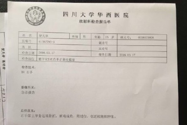 瘋狂！特雷